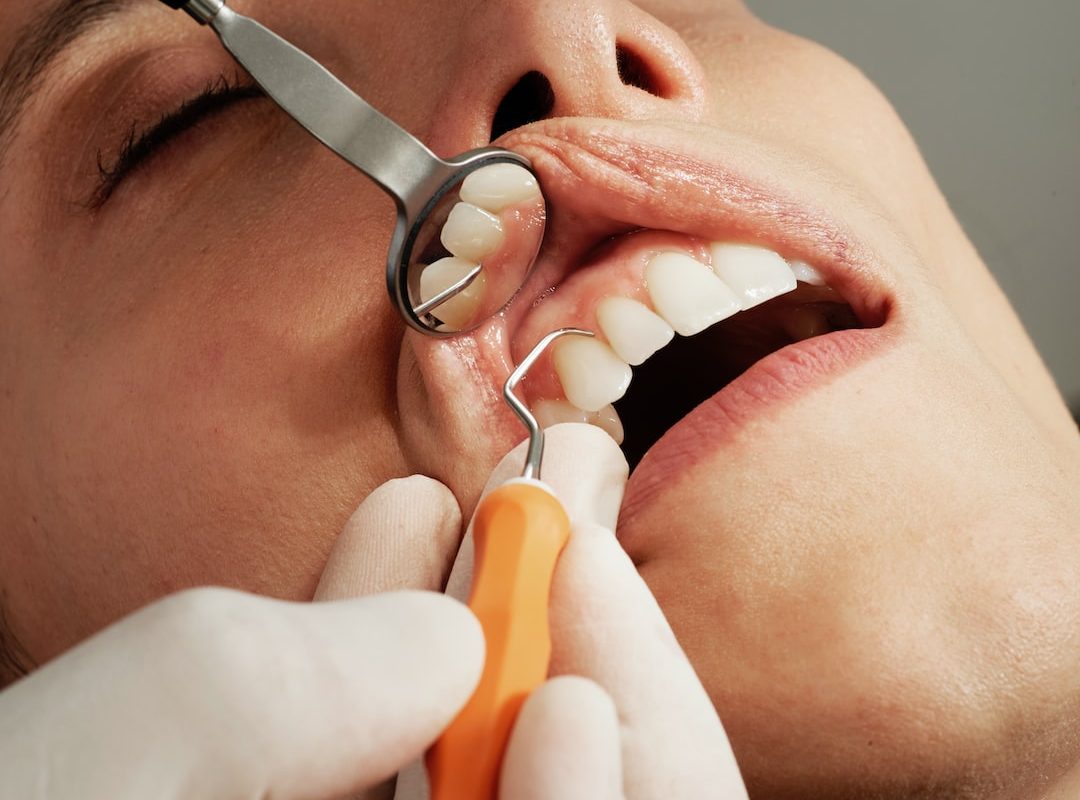 Narzędzia stomatologiczne – nieodzowny zestaw dla Twojego uśmiechu